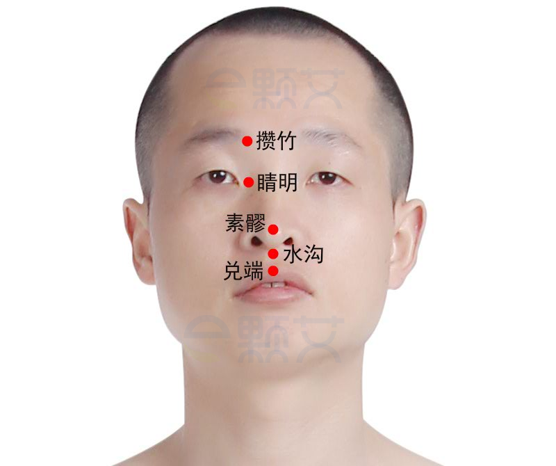 睛明穴位图 艾灸取穴方法 主治病症 应用经验