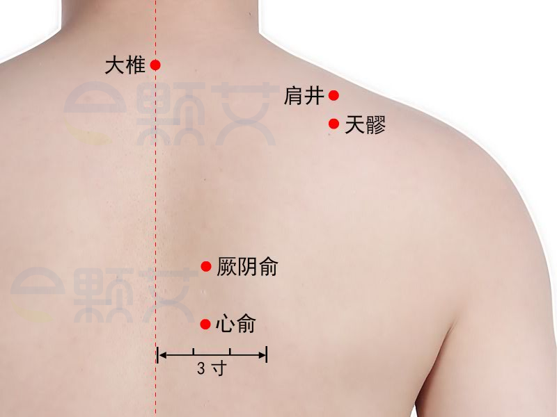 天髎穴位图 艾灸取穴方法 主治病症 应用经验