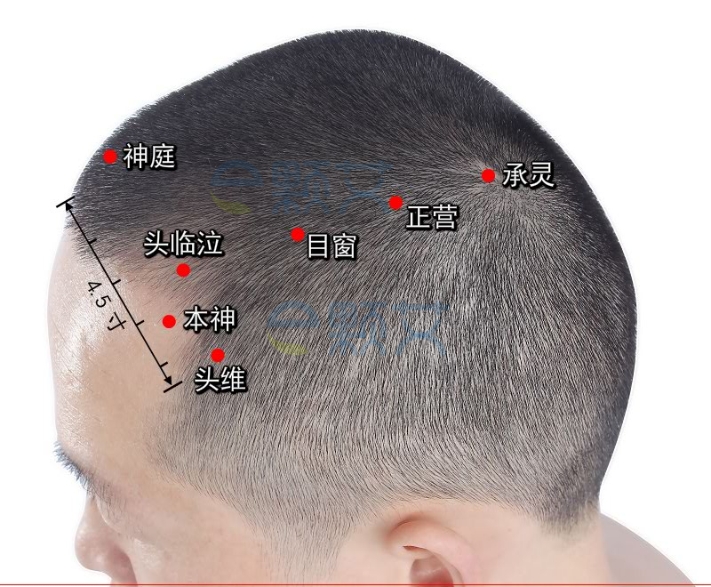 承灵穴位图 艾灸取穴方法 主治病症 应用经验