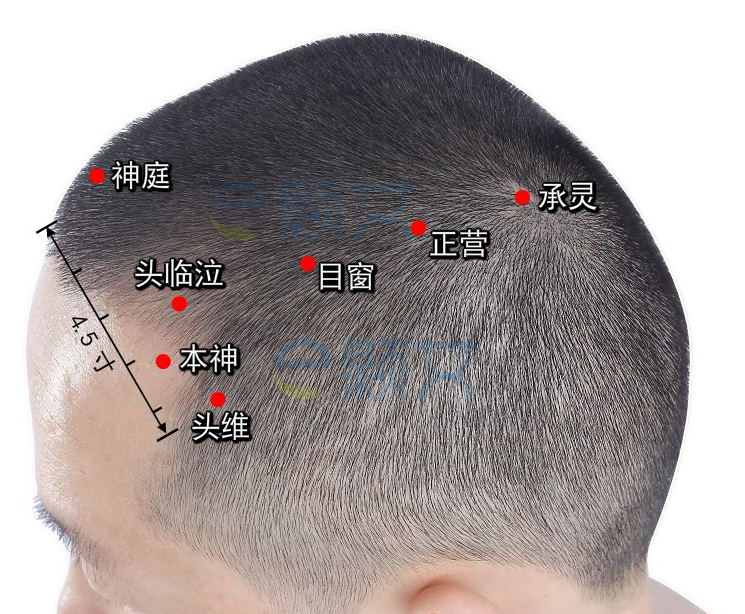 目窗穴位图 艾灸取穴方法 主治病症 应用经验