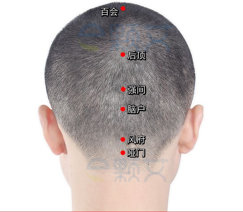风府穴位图 艾灸取穴方法 主治病症 应用经验