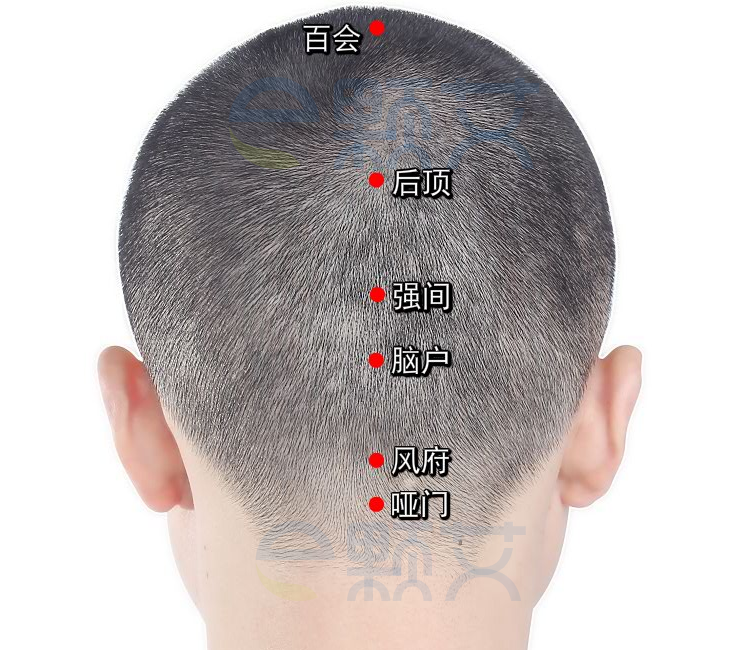 后顶穴位图 艾灸取穴方法 主治病症 应用经验