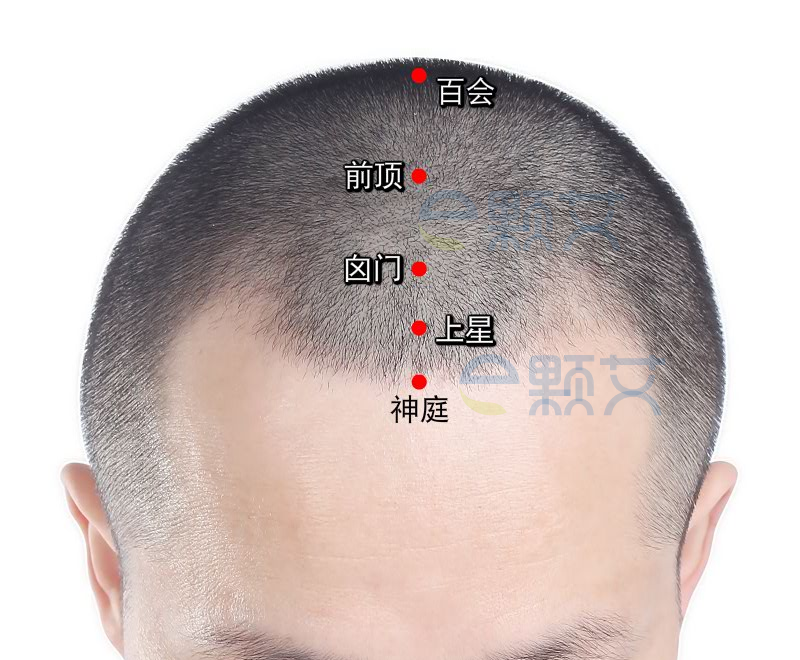 囟门穴位图 艾灸取穴方法 主治病症 应用经验