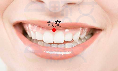 龈交穴位图 艾灸取穴方法 主治病症 应用经验