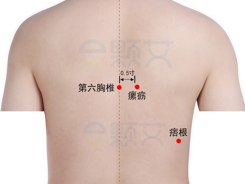 痞根穴位图 艾灸取穴方法 主治病症 应用经验